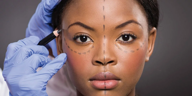 What to consider when undergoing cosmetic treatment