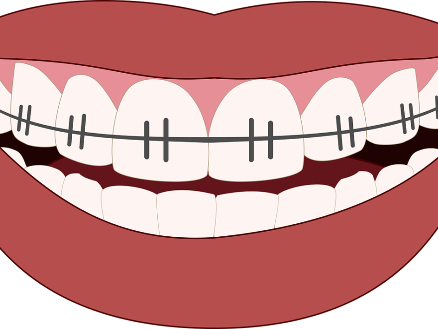 Orthodontiacs Bella Vista