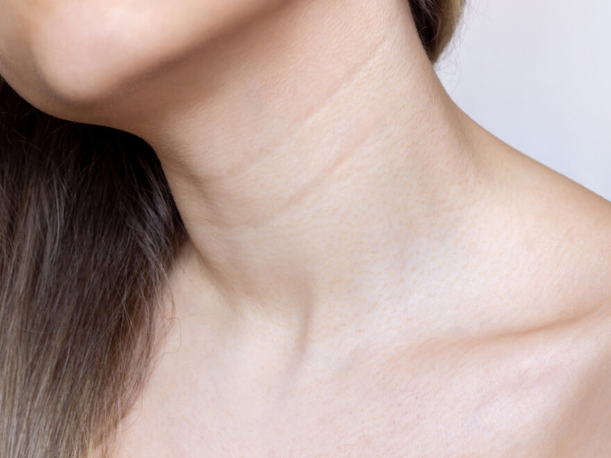 botox on neck wrinkles