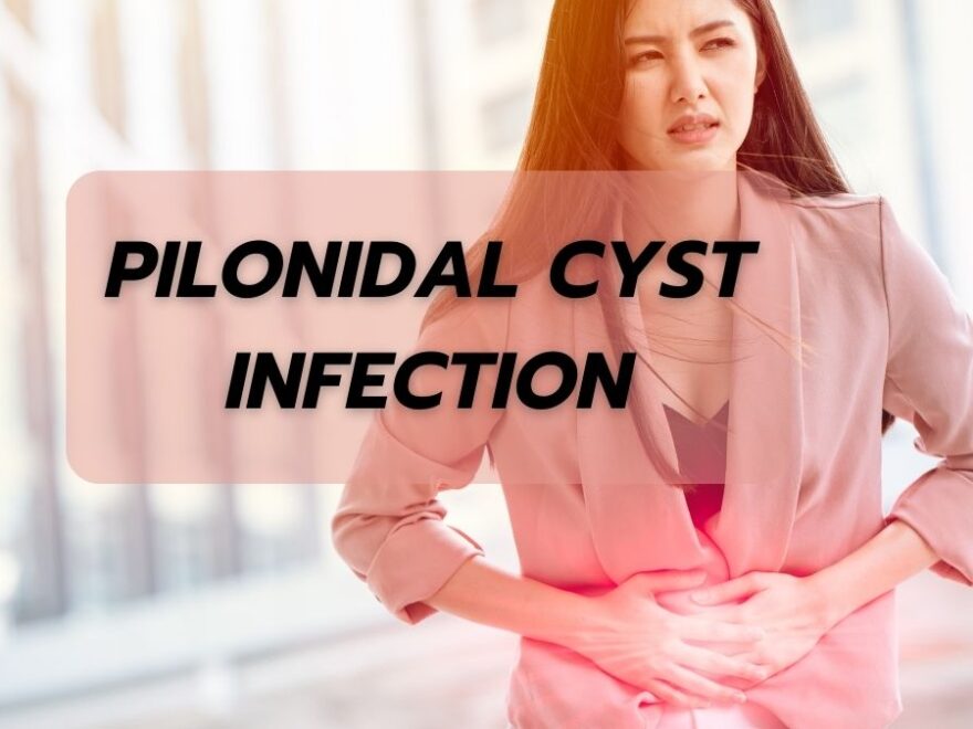 Pilonidal Cyst Infection