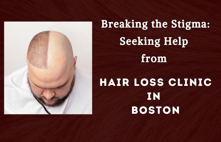 Breaking-the-Stigma-Seeking-Help-from-Hair-Loss-Clinic-in-Boston